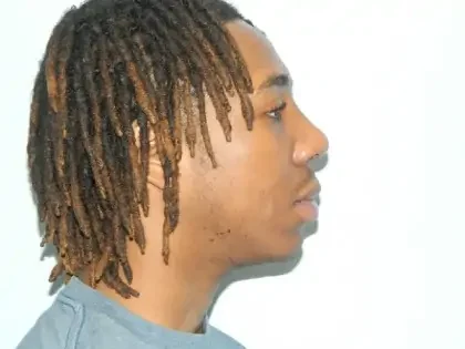 After Photo of Chin Augmentation in Philadelphia