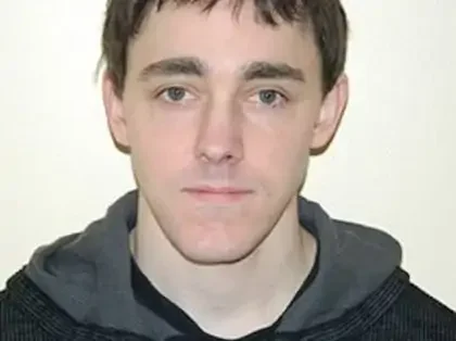 Before Photo of Chin Reduction in Philadelphia