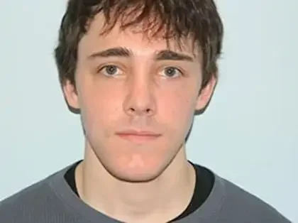 After Photo of Chin Reduction in Philadelphia