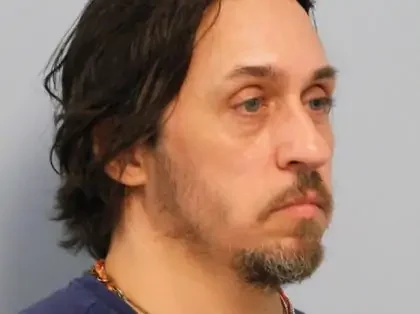 Before Photo of Rhinoplasty in Philadelphia