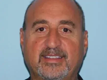 Before Photo of Rhinoplasty in Philadelphia