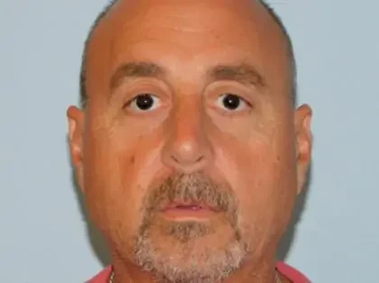 After Photo of Rhinoplasty in Philadelphia