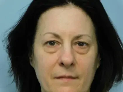 Before Photo of Blepharoplasty in Philadelphia